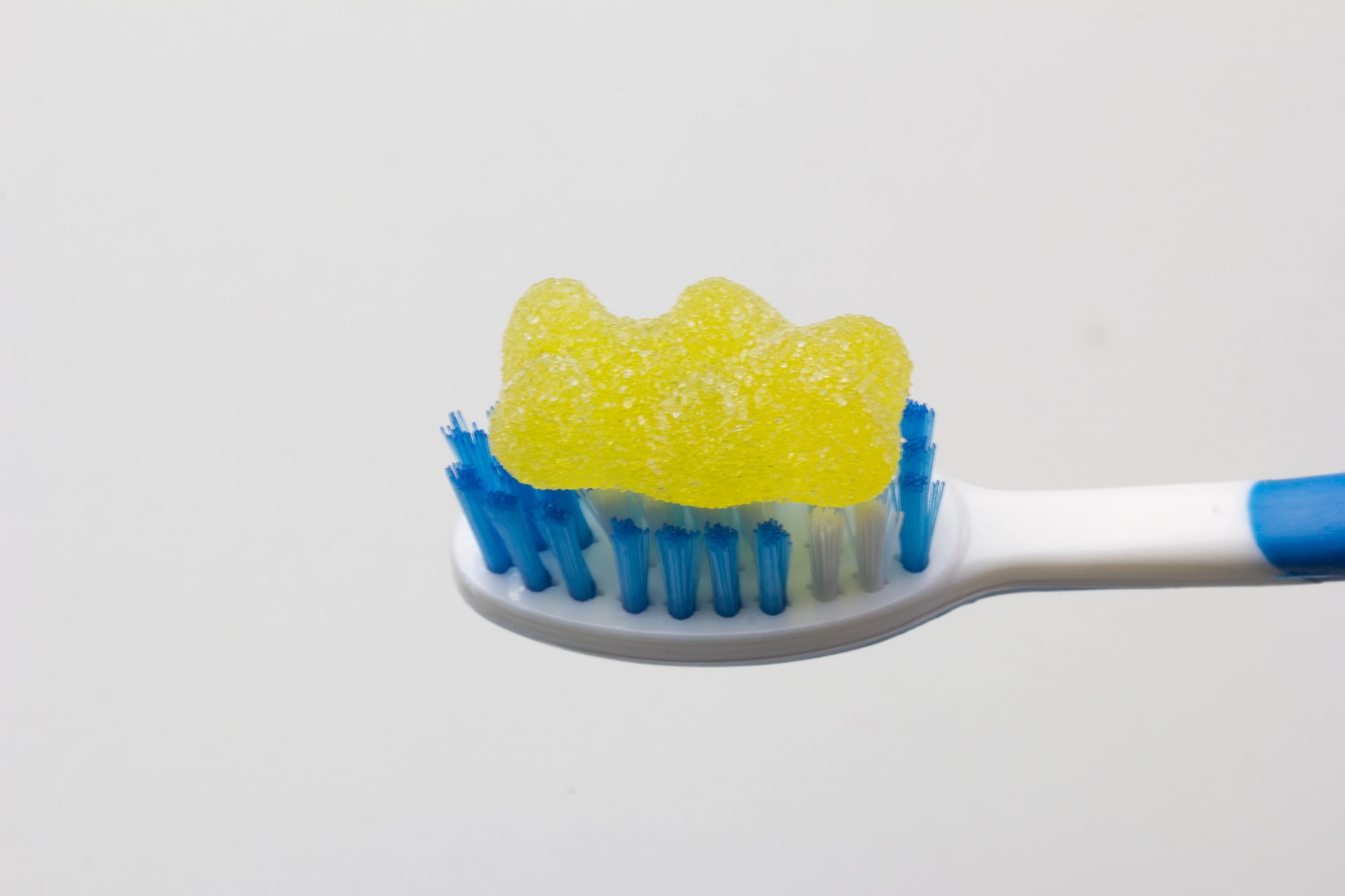Pulpitis Cat ¿Qué es la Pulpitis? - Tipos de Pulpitis - Nart Clínica Dental