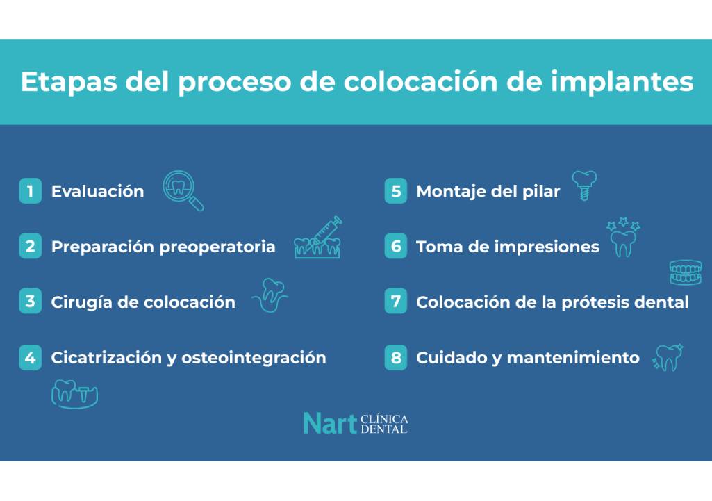 etapas del proceso de colocacion de implantes