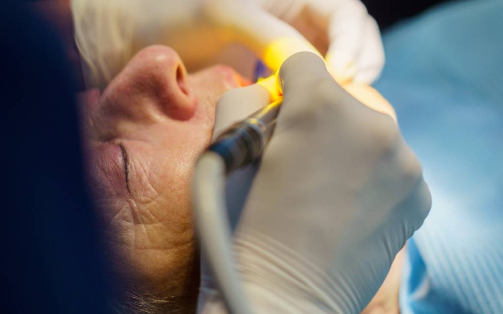Implantes dentales 